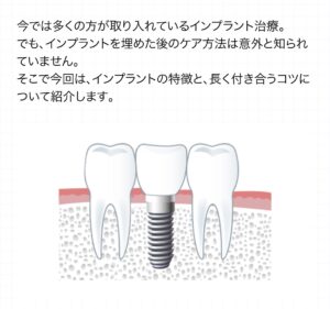 インプラント治療後の患者さまにご満足いただいております!